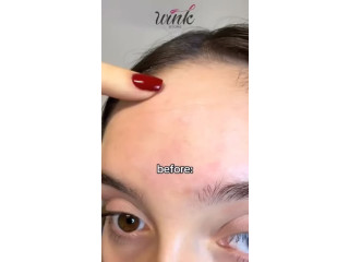 Wink Store Skin Treatment