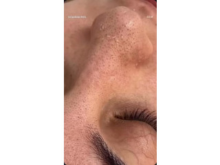 جلسات عناية عميقة + تنظيف + ماسكات طبيعية